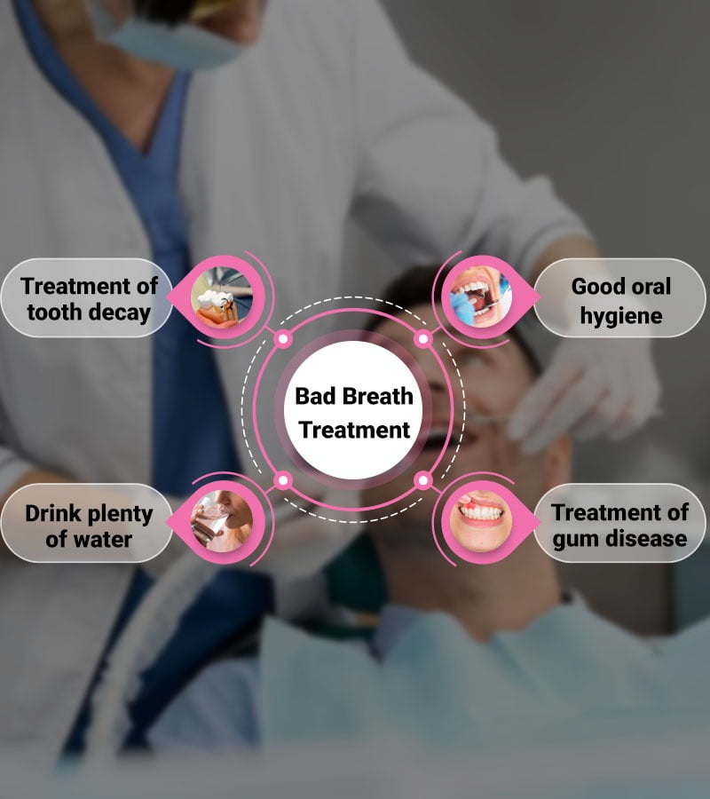 Bad Breath Treatment
