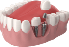 What Is Dental Surgery And Why It Is Used
