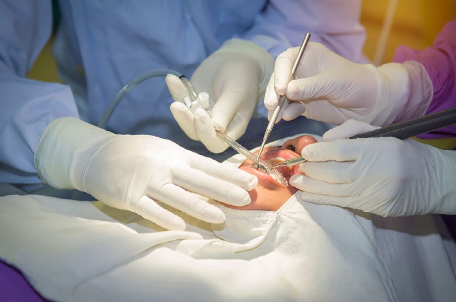 Oral surgery treatment