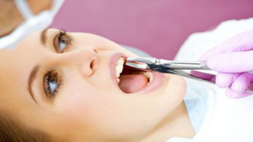 Best Teeth extraction clinic