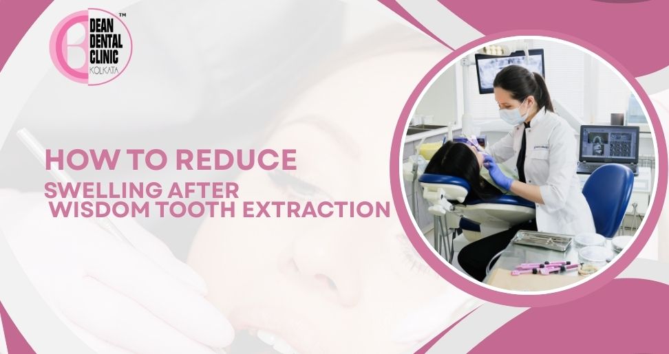 How to Reduce Swelling After Wisdom Tooth Extraction
