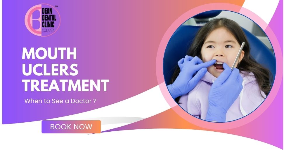 Mouth Ulcer Treatment: When to See a Doctor