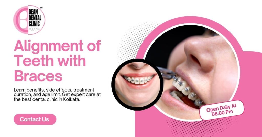 Alignment of Teeth with Braces: Complete Guide to a Perfect Smile