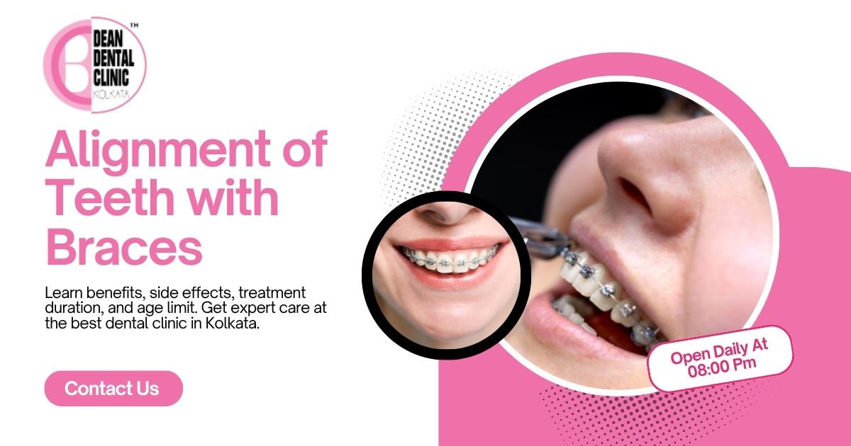 Alignment of Teeth with Braces: Complete Guide to a Perfect Smile