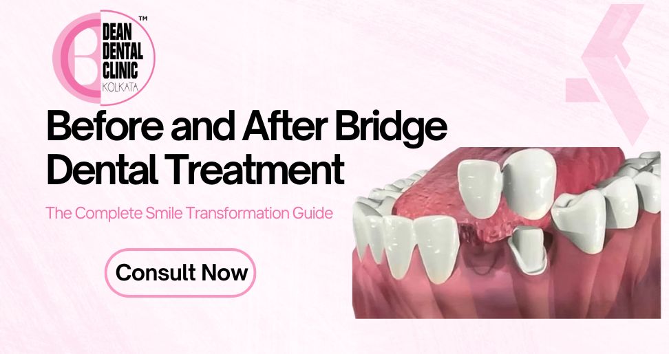 Before and After Bridge Dental Treatment: The Complete Smile Transformation Guide | Dean Dental